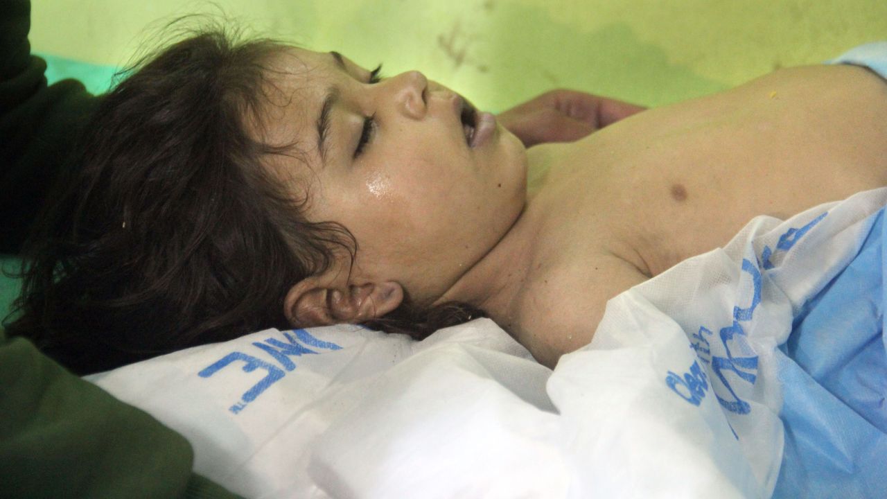 An unconscious Syrian child receives treatment at a hospital in Khan Sheikhoun.