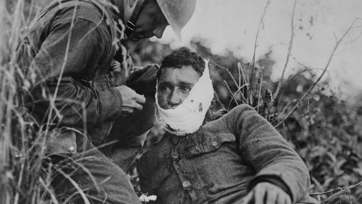 A US soldier treats a comrade's wound in France in 1918. World War I changed the US in ways that linger. 