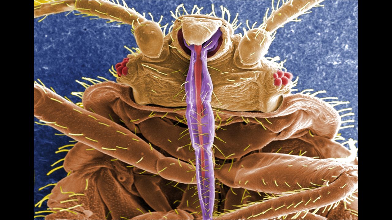 This is a digitally colorized electron micrograph scan of the underside of a bed bug. The purple spike is the insect's skin piercing-sucking mouth it uses to devour its meal. The prickly hairs on the body aren't hairs at all but sensory structures known as setae.