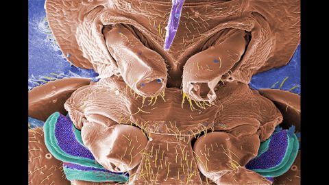 This micrograph shows a few of the six jointed legs of a bedbug. <br /><br />Scientists believe that the purple and green structures are the scent gland, responsible for a cloyingly sweet, musky odor the bug emits, one way to identify an infestation.