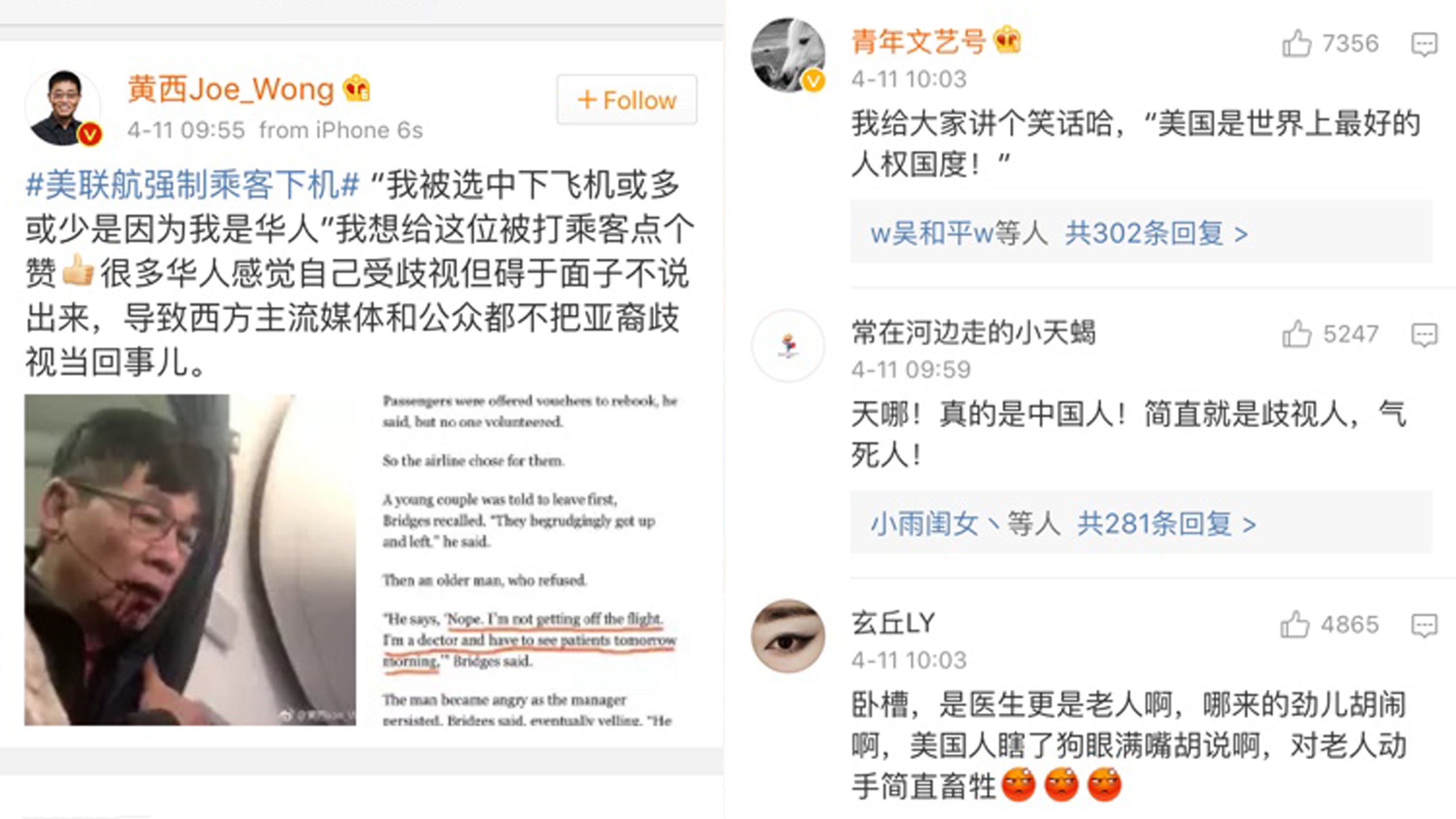 Comedian Joe Wong was among many Chinese commenters on social media denouncing United's treatment of an Asian passenger. Wong denounced the airline for "discrimination" against Asians. 