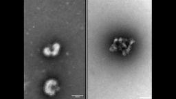 A side-by-side electron microscope image of a flu virus before and after being exposed to the urumin peptide.
