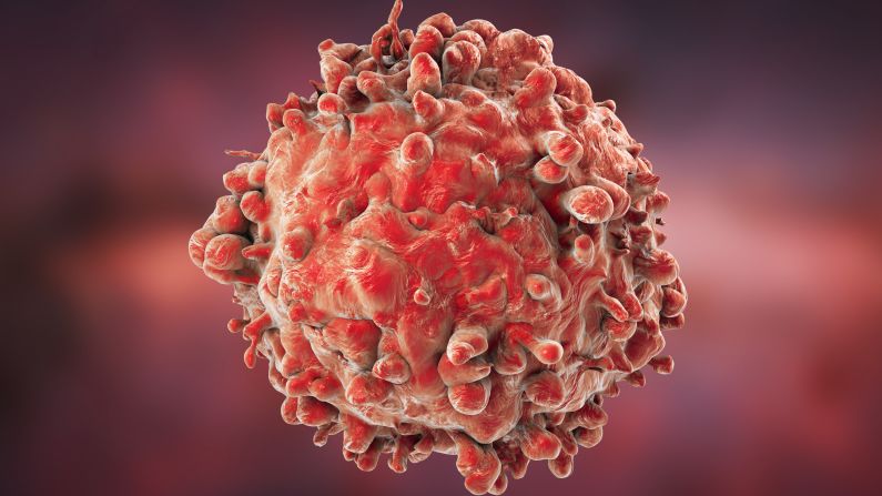 The most common childhood cancer in the United States today is acute lymphocytic leukemia, striking nearly 3,000 children a year. In 1975, it was a death sentence, but after years of research new medication combos, today 90% of newly diagnosed children are expected to live five years or more.