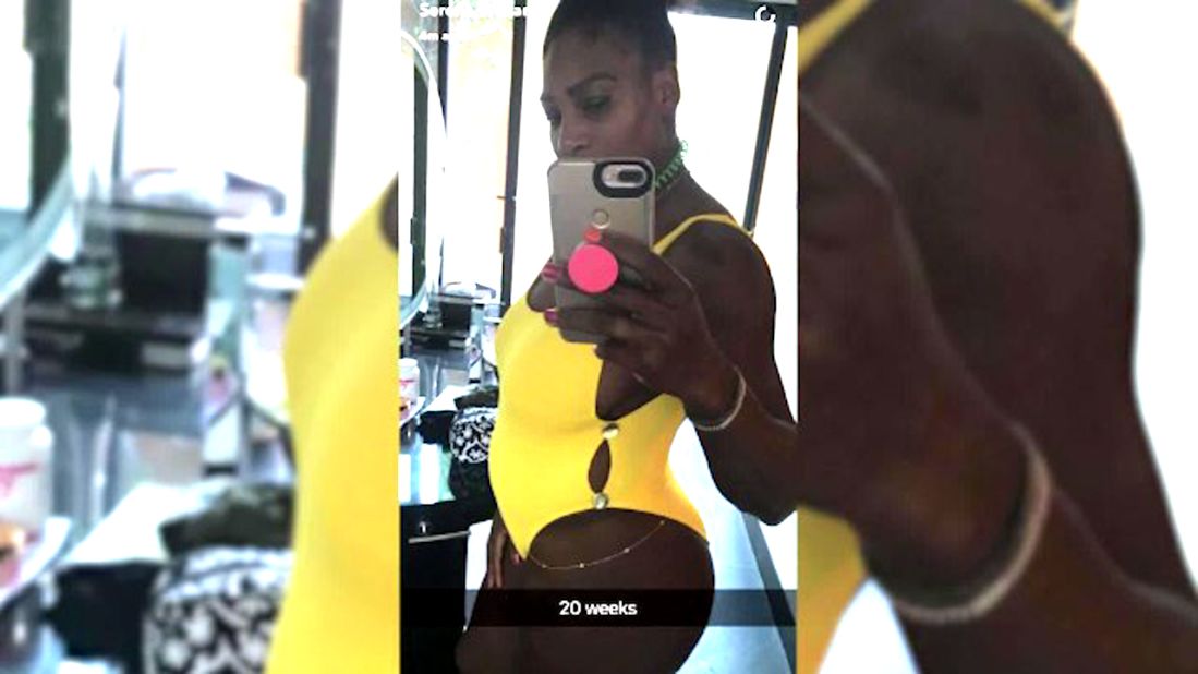 Williams had posted a side profile shot of herself in a yellow swimsuit on Snapchat with a caption that read "20 weeks" before deleting it, later revealing she did not mean to post the picture. 