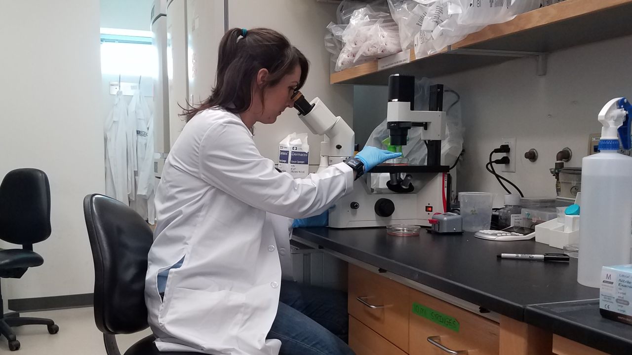 Paul works on trying to figure out how melanoma spreads to other parts of the body.