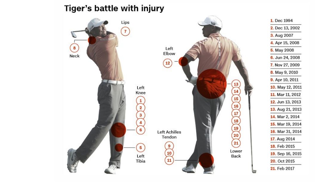 tiger woods injuries timeline