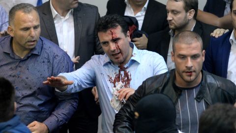 With blood on his face, Zoran Zaev, the leader of Social Democratic Union of Macedonia, tries to leave the Macedonian Parliament in Skopje, 27 April 2017.