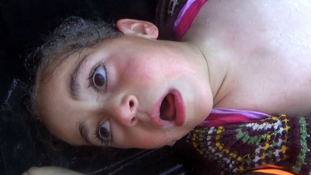 A little girl gasps for air in the moments after the attack.