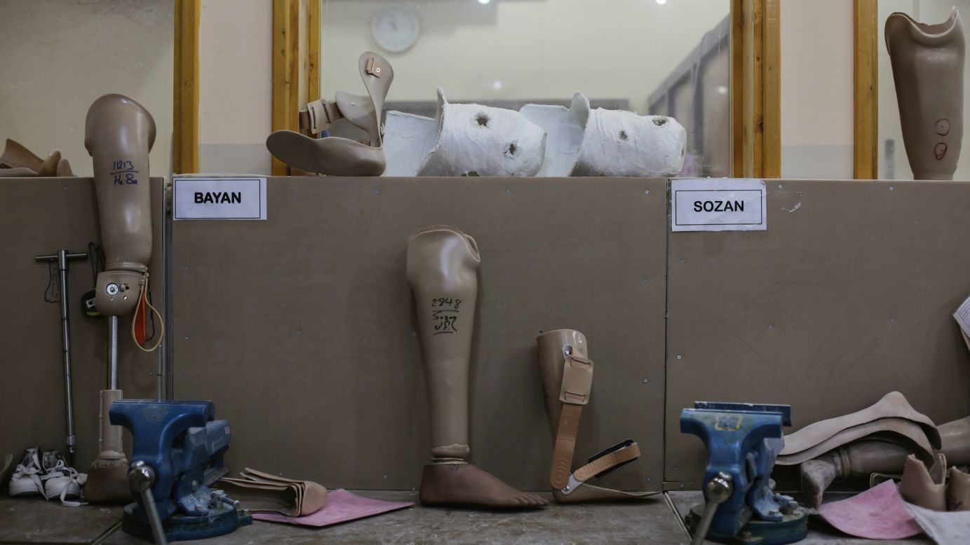Prosthetic legs are seen at a Red Cross clinic in Irbil, Iraq, on Wednesday, May 10. The clinic receives more than 450 new patients a month.