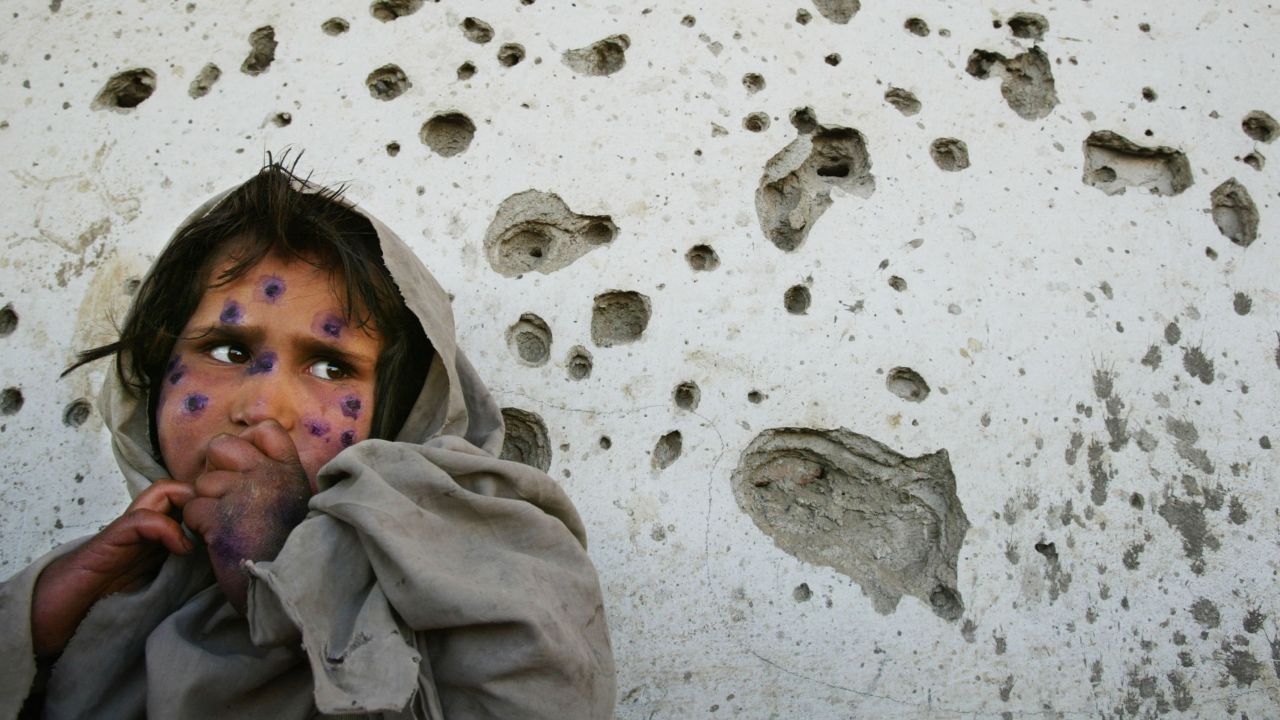 Mohboba, 7, stands near a bullet-ridden wall in Kabul as she waits to be seen at a health clinic on March 1, 2002. She had a skin ailment that plagued many poverty-stricken children in Afghanistan.
