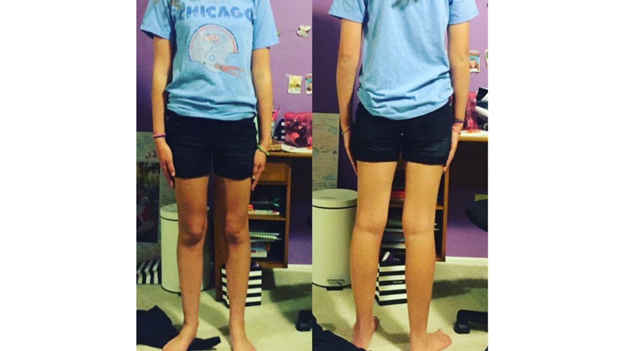 Catherine Pearlman's daughter in the shorts that she says violated her school's dress code.