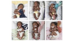 The Taiwo sextuplets were born on May 11, 2017 at VCU Medical Center. The three boys and three girls are in good condition in the Neonatal Intensive Care Unit at Children's Hospital of Richmond at VCU. 