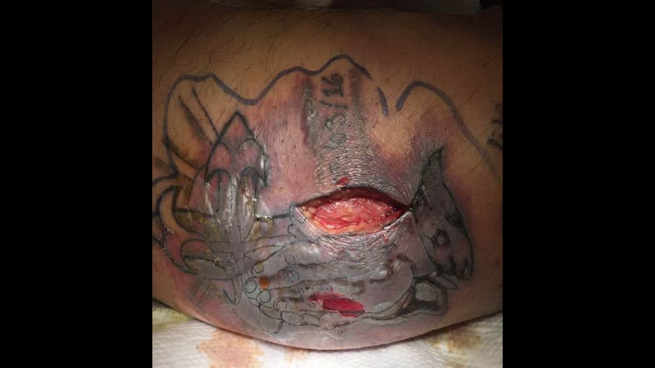 Man dies after swimming with new tattoo | CNN