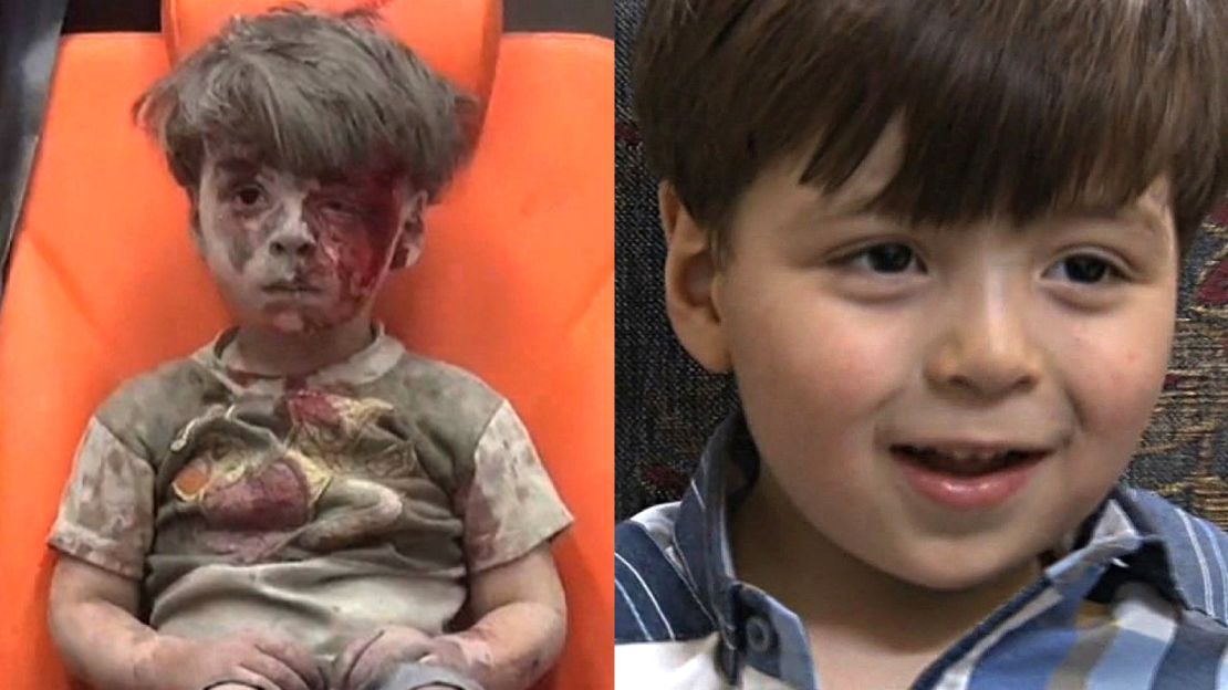 The image of Omran Daqneesh taken last August (left), and how he appeared in Syrian TV interviews.