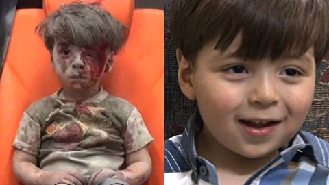 The image of Omran Daqneesh taken last August (left), and how he appeared in Syrian TV interviews.