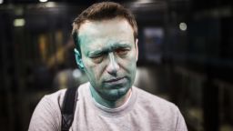 In this April 27, 2017 photo, Russian opposition leader Alexei Navalny is seen after unknown attackers doused him with green antiseptic outside a conference venue in Moscow, Russia. Russian opposition leader Alexei Navalny wrote on Instagram on Tuesday May 9, 2017 that he has undergone eye surgery in Spain and that doctors expect the vision in his right eye to be restored in several months, after being attacked.