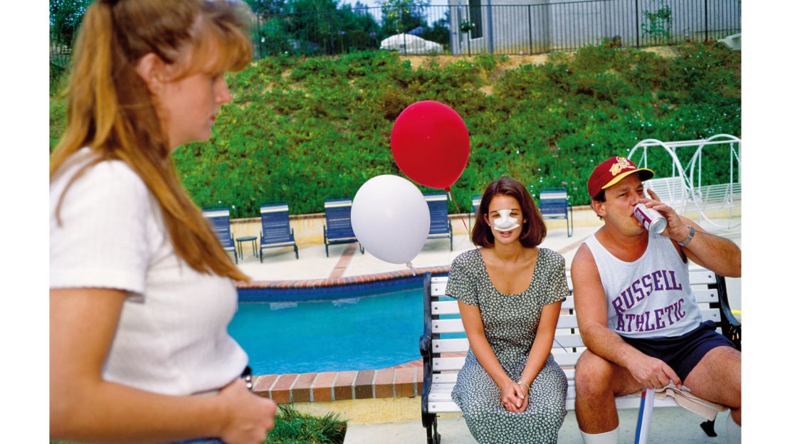 "I had wanted to get my nose done since I was twelve," Lindsey told Lauren Greenfield.
