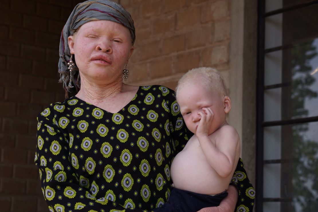 Miyango Tiziwa and her child, residents of Ukerewe Island's albino community.