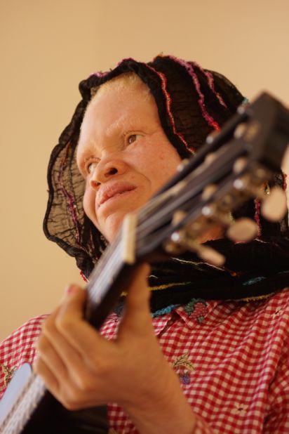 The result of those sessions, "White African Power" by the "Tanzania Albinism Collective," has been released prior to the United Nation's third International Albinism Awareness Day. Among the artists featured is Thereza Phinias (pictured), who contributed three songs including the upbeat album closer "Happiness."