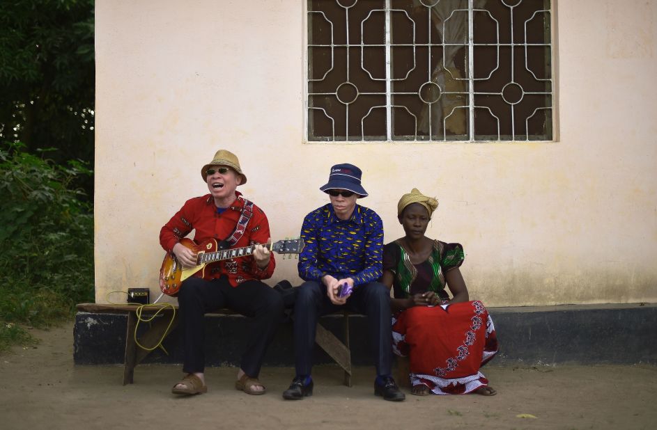 Albino singer King Shube plays a guitar on Ukerewe, 2016.  King Shube is an exception among the island's albino community. Many were actively discouraged from singing or banned according to music producer Ian Brennan, who visited the island and recorded sessions with locals in summer last year.