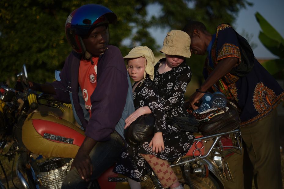 Two young sisters with albinism sit on a motorbike on Ukerewe. The island's reputation as a community in which those with albinism are greater integrated with those without it, has led some parents to relocate with their children.