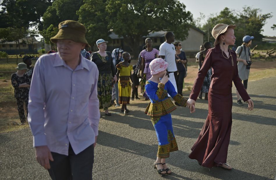 Ukerewe Island in Lake Victoria has become a a safe haven for a community of Tanzanians living with albinism. Many albinos face threats from organ and limb harvesters, and wider ostracism is also a problem.