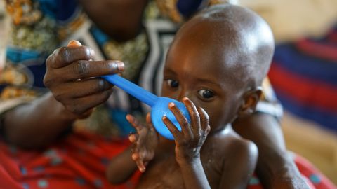 <strong>Niger:</strong> A baby with acute malnutrition drinks fresh, clean water in Agui. Here, 43% of children up to age 5 have stunted growth from malnourishment.