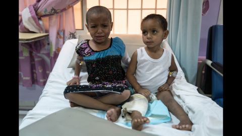 Ahmed, three, and his six-year-old sister Khaoula were orphaned in an airstrike on their house. Ahmed's knee is completely broken and medical staff say that his right leg will no longer grow. Khaoula lost her teeth and most of her tongue in the attack. 