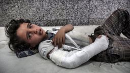 A young boy lies in the emergency room awaiting treatment of Al Joumhouri Hospital in the Yemeni capital, Sana'a.


