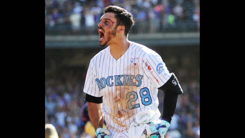 Colorado's Nolan Arenado celebrates after hitting a home run to beat San Francisco on Sunday, June 18. He was accidentally bloodied while celebrating with his teammates at home plate. The home run also completed the first cycle of Arenado's career. 