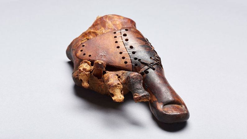 This prosthetic device was made for a priest's daughter who had to have her right big toe amputated 3,000 years ago. This <a href="index.php?page=&url=http%3A%2F%2Fwww.cnn.com%2F2017%2F06%2F22%2Fhealth%2Fancient-egypt-wooden-toe-prosthetic-trnd%2Findex.html">surprisingly lifelike toe</a> was made to look natural by a skilled artisan who wanted to maintain the aesthetic as well as mobility during the Early Iron Age. It was designed to be worn with sandals, the footwear of choice at the time.