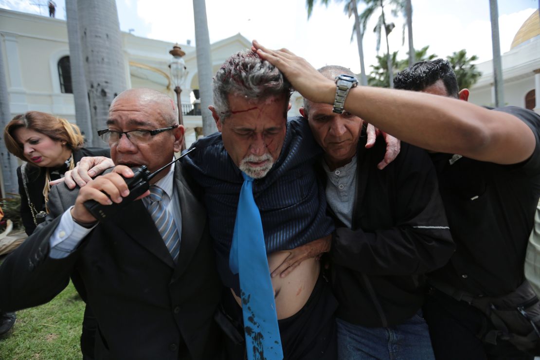 Opposition lawmaker Americo De Grazia is led away by bodyguards and a National Assembly employee after he was injured by government supporters.  