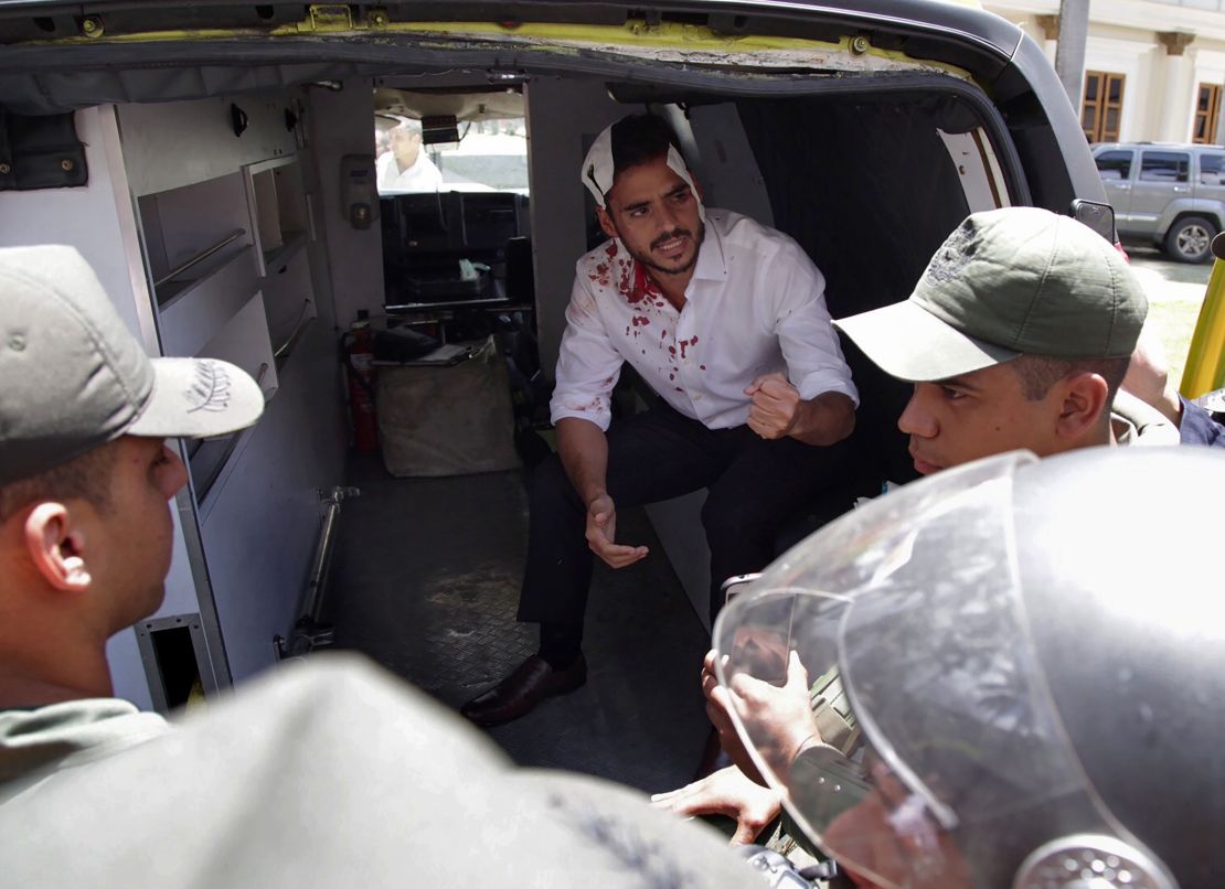 Opposition deputy Armando Armas  is assisted after being injured by supporters of Venezuelan President Nicolas Maduro.