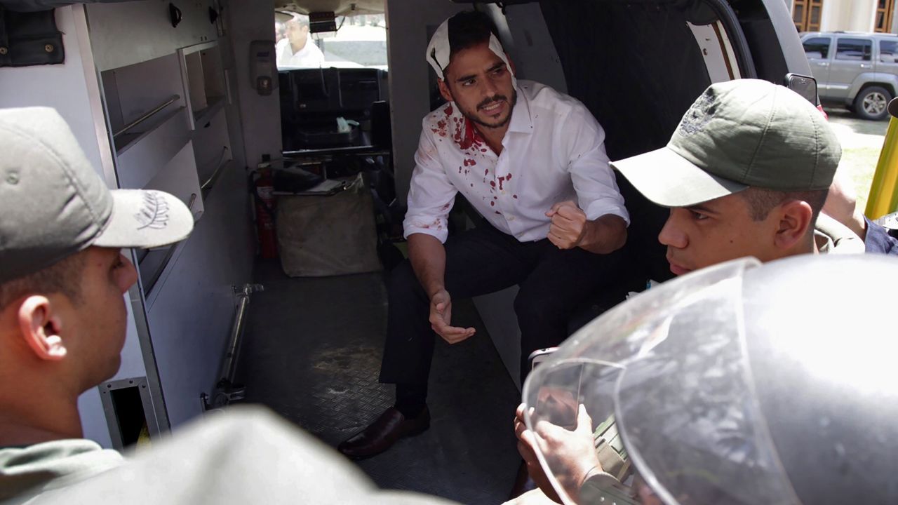 Opposition deputy Armando Armas  is assisted after being injured by supporters of Venezuelan President Nicolas Maduro.