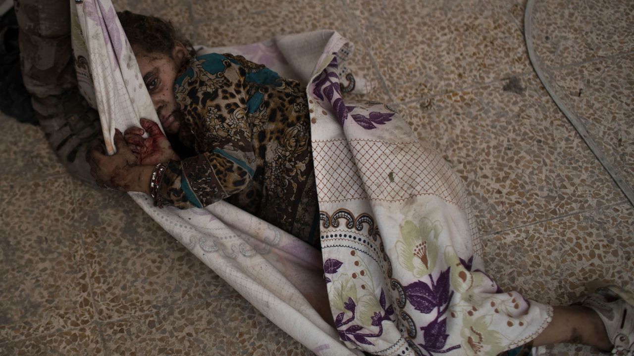 This injured girl was found by Iraqi forces as they <a href="http://www.cnn.com/2017/06/29/middleeast/iraq-mosul-fighting/index.html" target="_blank">advanced against ISIS militants</a> in the Old City of Mosul on Monday, July 3. She was carried away for medical assistance.