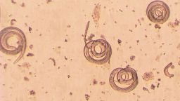 Trichinella spiralis - parasitic worm microscope; Shutterstock ID 183701153