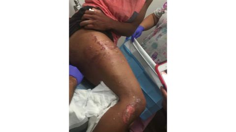 A photo released by the NAACP showing Hargrove's injuries.