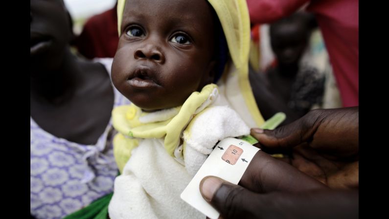 In a remote village in South Sudan, CARE conducts nutrition and vaccination outreach to help people displaced by conflict and flooding.  Children were weighed and measured to determine malnourishment.