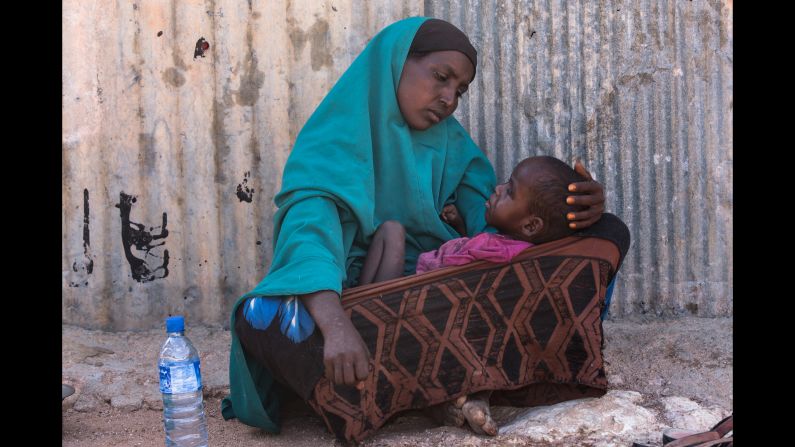 Hodan, a mother of five, holds her 2-year-old son in the town of Kiridh, Somalia. The boy went blind following illness as an infant and now suffers from severe malnutrition. The nearest hospital is several hours away.