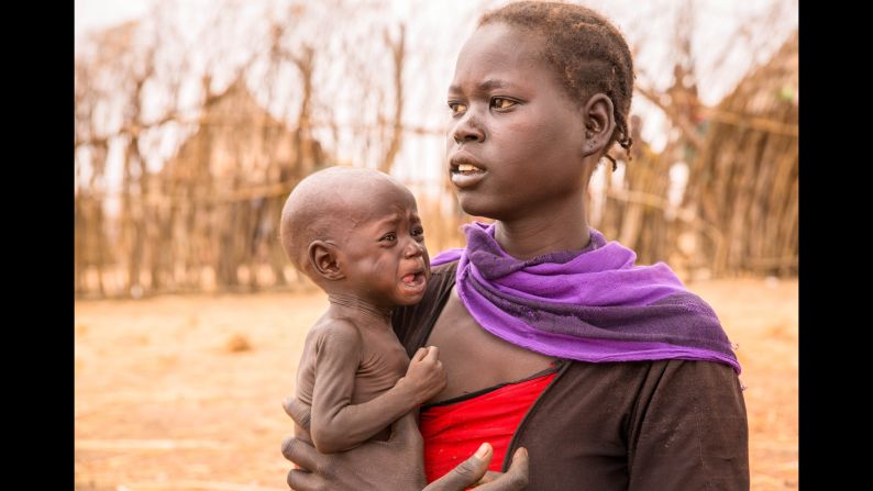 Adele Bol walked more than three hours with her 10-month-old daughter to reach a food distribution center in South Sudan. Bol has two other children who are as malnourished as her infant. "I haven't eaten in days, and that's why I don't have any breast milk to feed my daughter," she says. 
