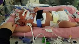 02 newborn nearly dies from human contact