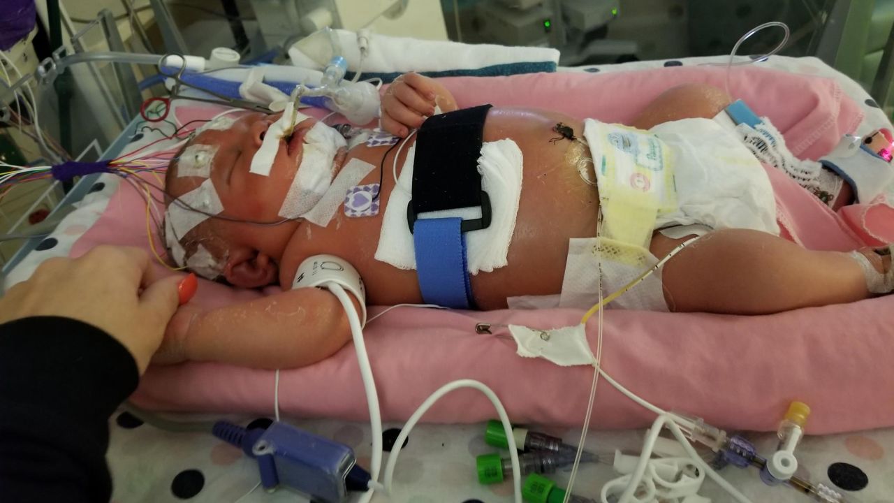 At nearly 3 weeks old, Mariana was fighting for her life.