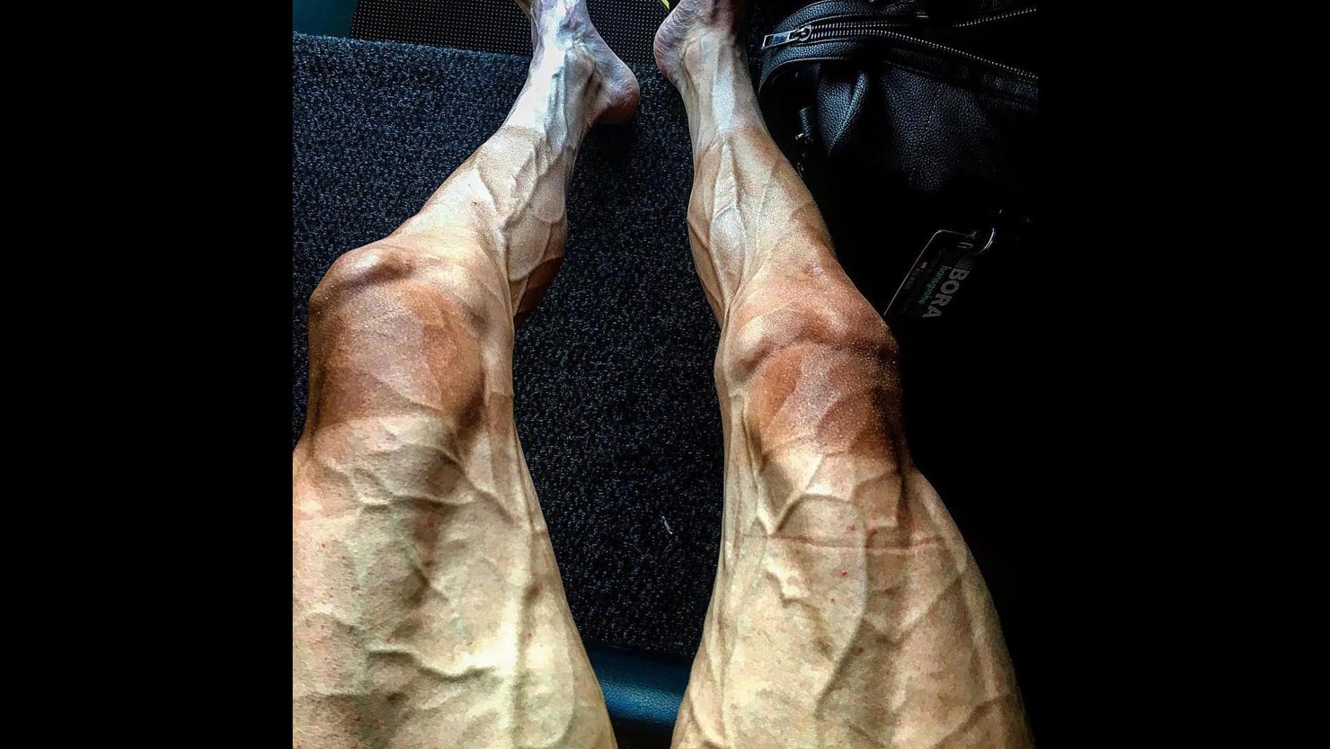 Pawel Poljanski posted a photo of his legs on Instagram.