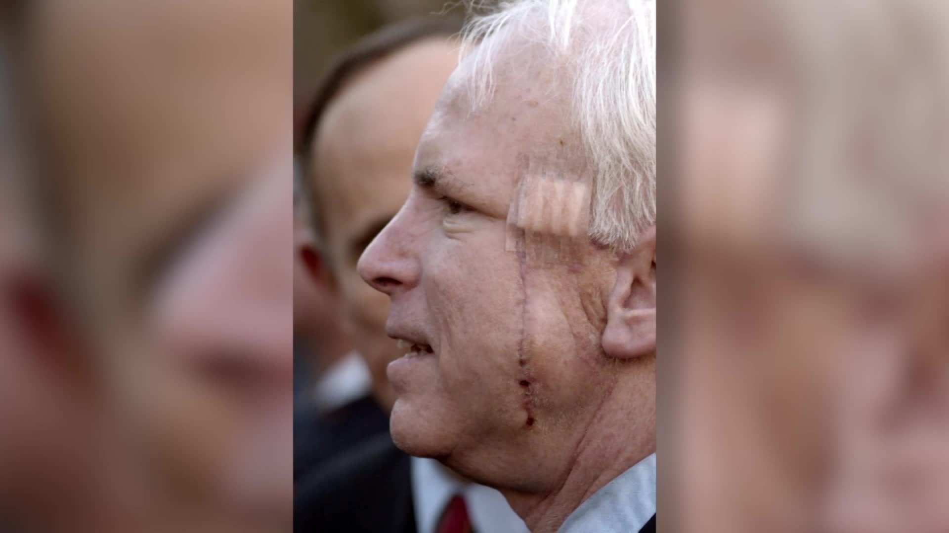 Sen. John McCain has brain cancer, aggressive tumor surgically removed | CNN