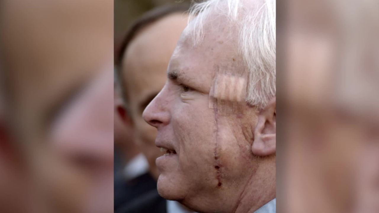 john mccain brain tumor diagnosis gupta dnt ac_00014000.jpg