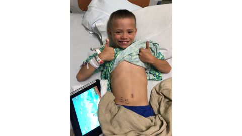Jackson Arneson poses before his kidney transplant surgery on June 22.