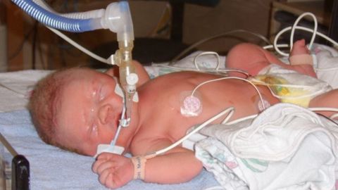 Jackson Arneson, now 9, was born with a condition called posterior urethral valves.