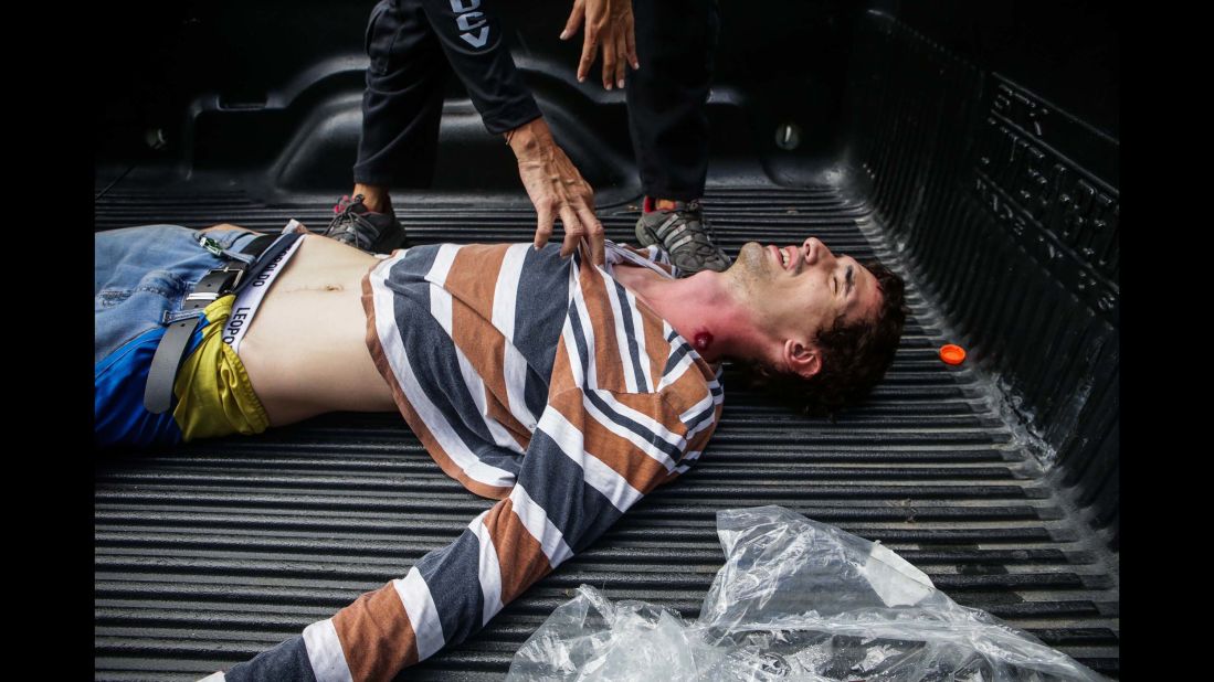 A protester wounded by a pellet gun receives attention July 30 during a demonstration against the vote for a Constituent Assembly.