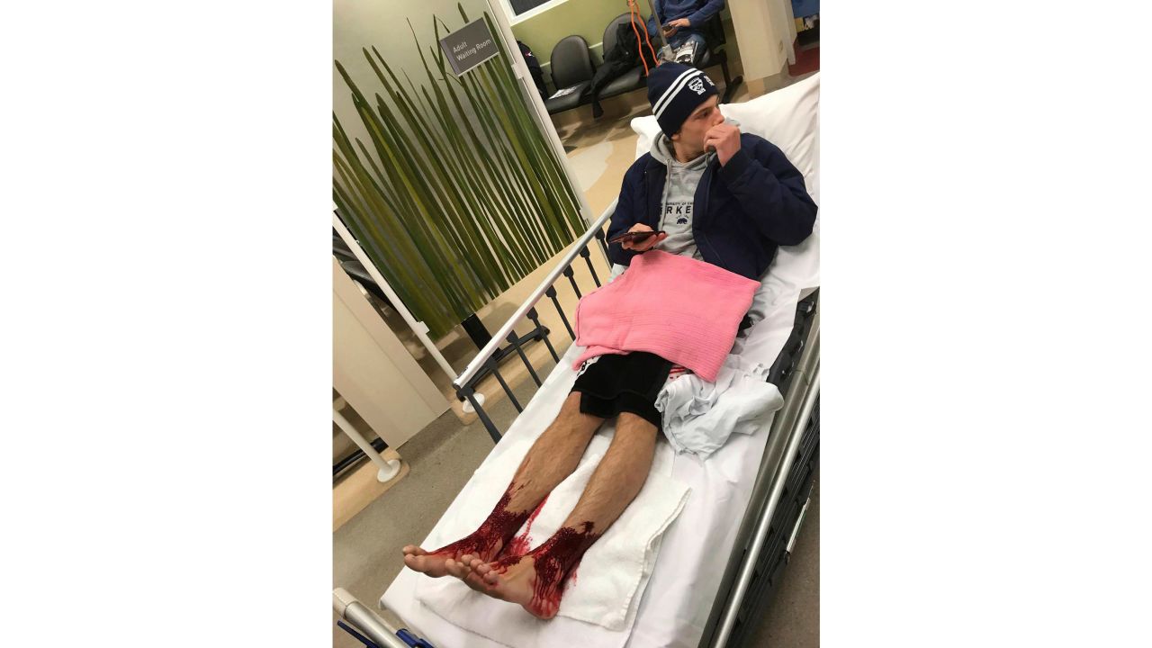 Sam Kanizay lies in bed while his feet bleed.