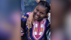 (WCBS) An 11-year-old Bronx girl was severely burned when a 12-year-old girl poured boiling water on her face during a sleepover, police said. "We're trying to keep her spirits up, talking to her," the victim's aunt, Lawrene Merritt told CBS2's Dave Carlin. Lawrene said her 11-year-old niece, Jamoneisha Merritt, has not been given a mirror to see the severe damage to her face and neck. Police said Jamoneisha was intentionally scald at a sleepover while surrounded by young girls she considered her friends. 